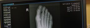 Foot Pain and Deformities