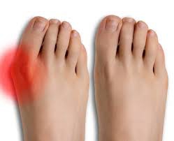 Foot Pain and Deformities
