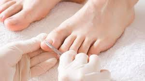 Skin and Nail Problems